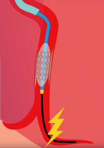 PCI Electroducer